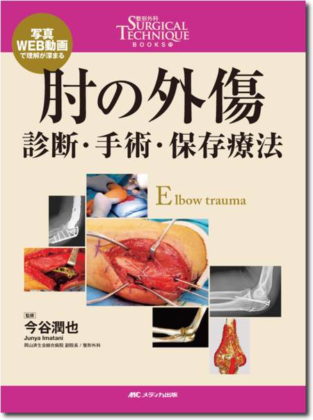 m3電子書籍 | 整形外科Surgical Technique BOOKS12 大腿骨近位部骨折